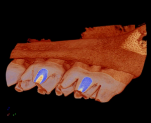 Figure 3 3D Model of a Micro-CT Scan of a Mandible