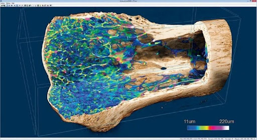 Bone morphometry