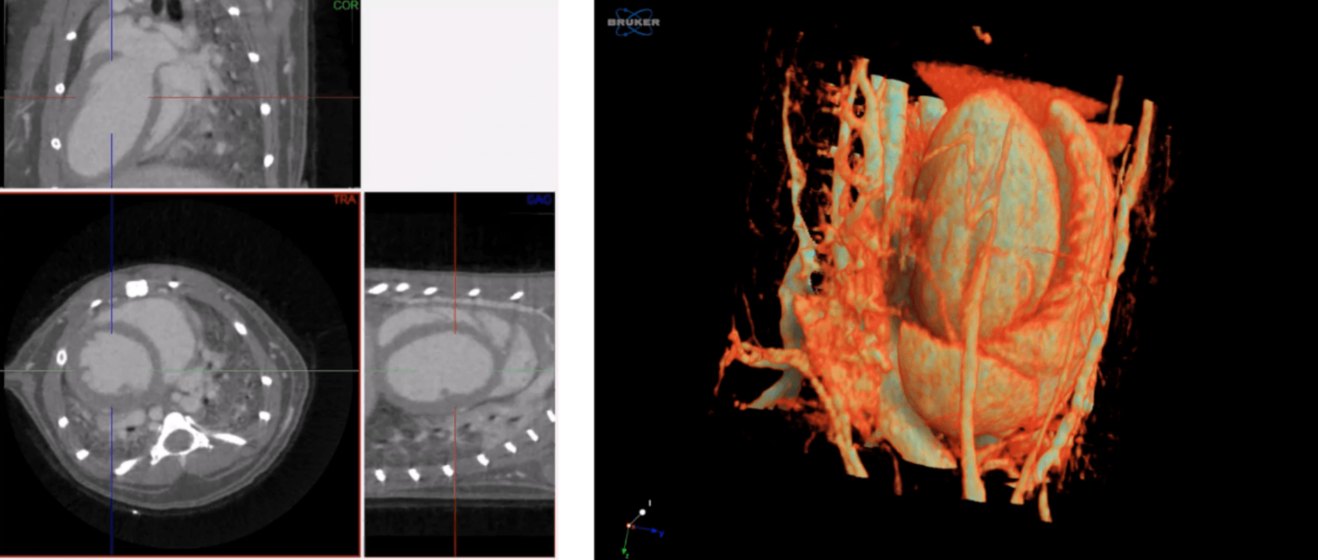 Cardiac gating