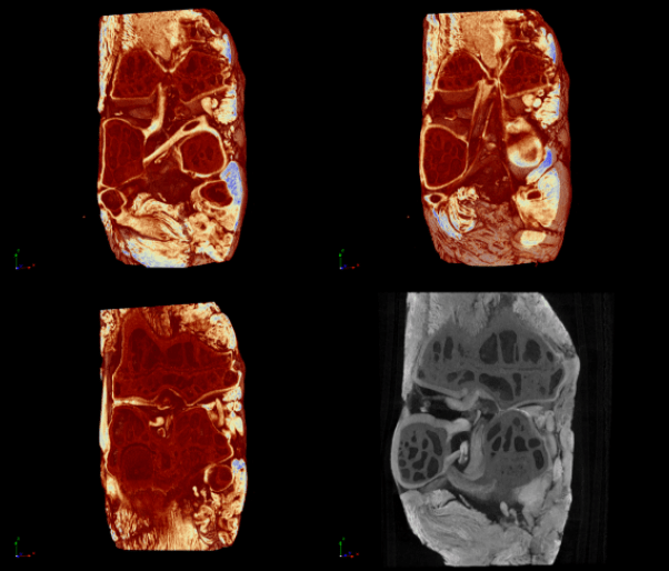 Cartilage analysis