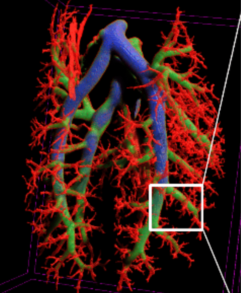 Rat lung, volume rendering