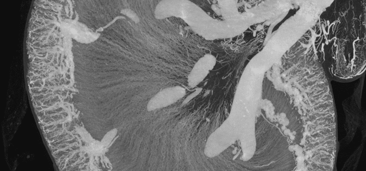 Infiltrated rabbit tubules