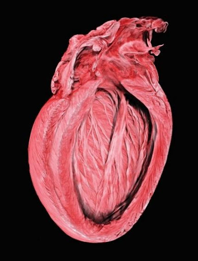 Soft tissue - heart