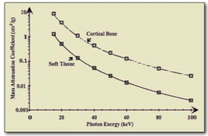 DEXA Bone vs. Soft Tissue